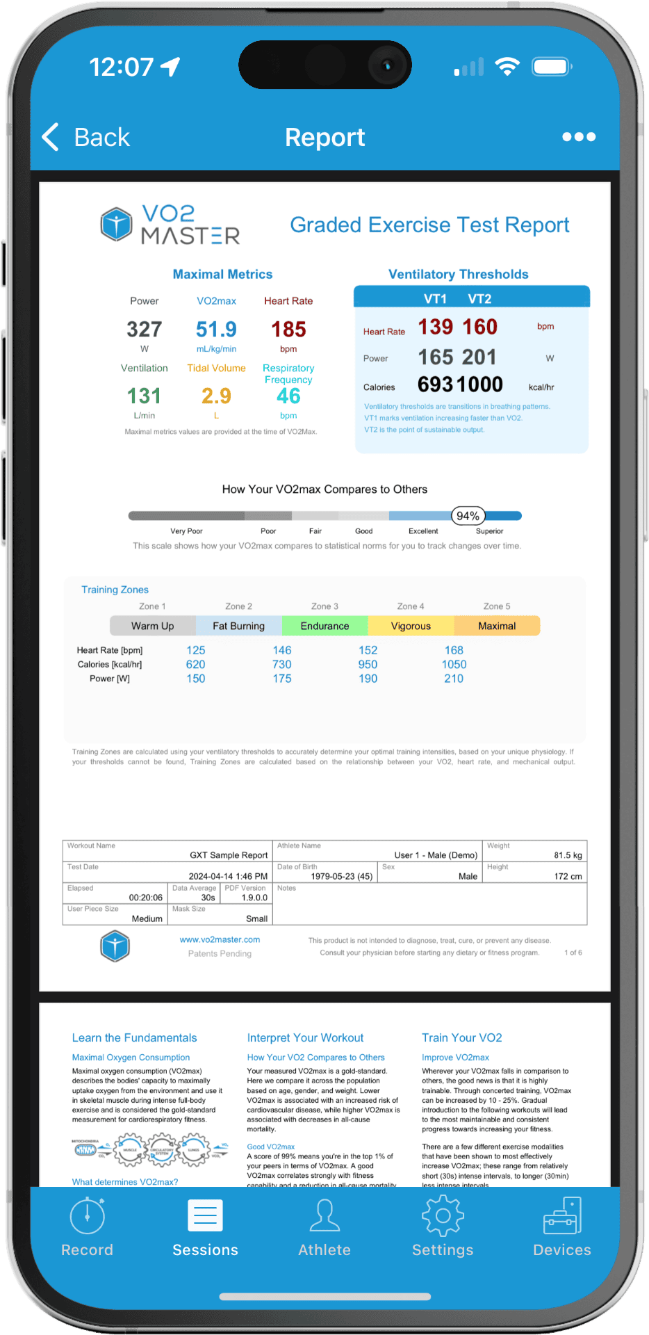 GXT Sample Report on iPhone